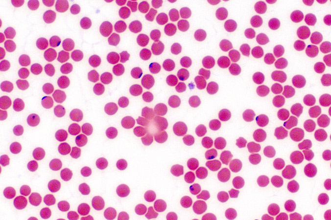 There are over 100 known species of Babesia.