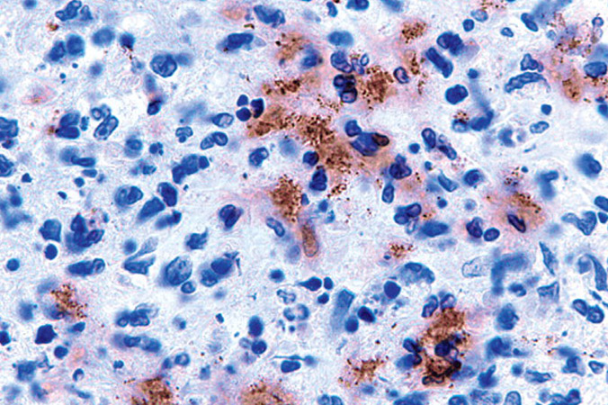 Bartonella bacteria can cause several diseases in humans.